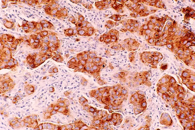 Científicos de la UNAM Desarrollan Vacuna Terapéutica contra el Cáncer de Mama